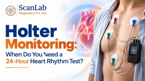 Holter Monitoring